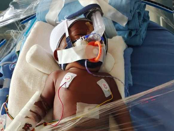 Help My Son Fight Lung Disease (Respiratory Distress)