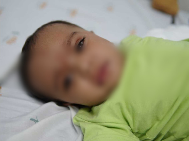 Liver Disease Has Endangered 7-Month-Old's Life, Needs Urgent Surgery