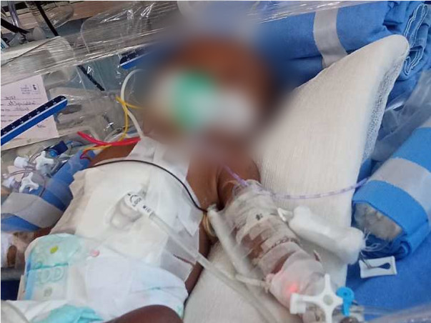 Help My Son Fight Lung Disease (Respiratory Distress)