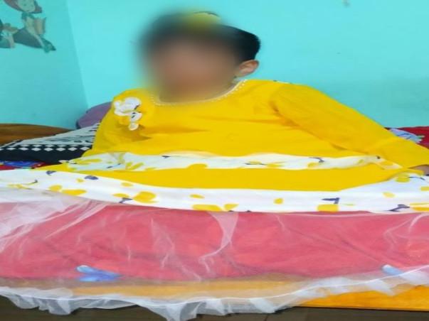 Help my daughter fight Focal Cortical Dysplasia