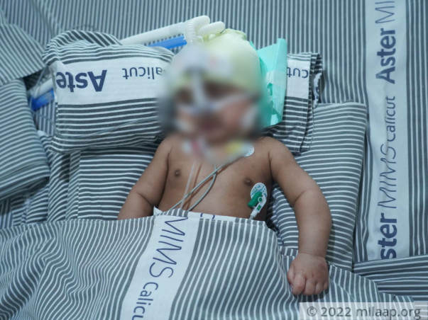 help-vishal-recover-g
