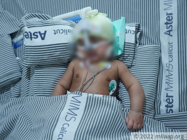 help-vishal-recover-fvd