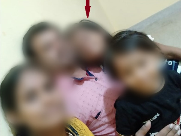 8 Years Old Brunda Needs Your Help to Fight Severe Burns