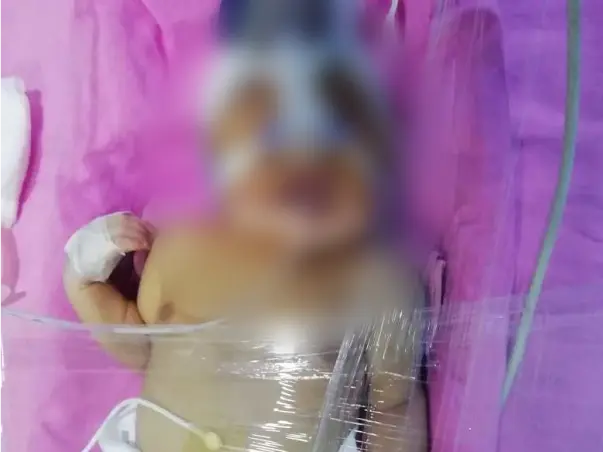 5 Days Old BABY Needs Your Help