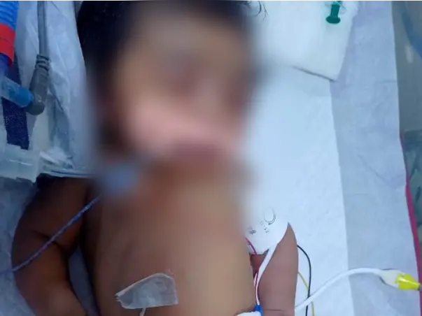 Support M Srinu To Save His Baby