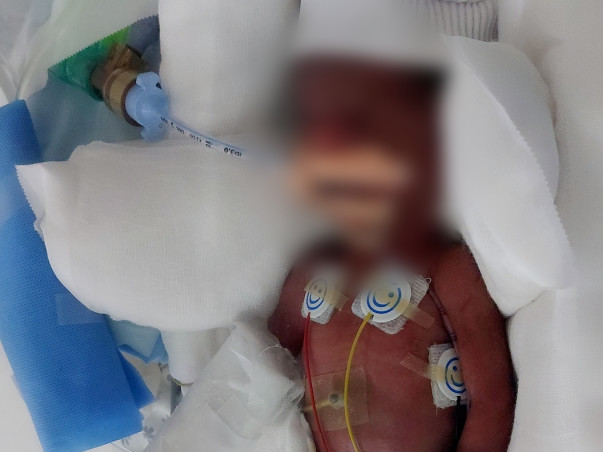 My son is struggling with digestion & breathing problems ,Please help