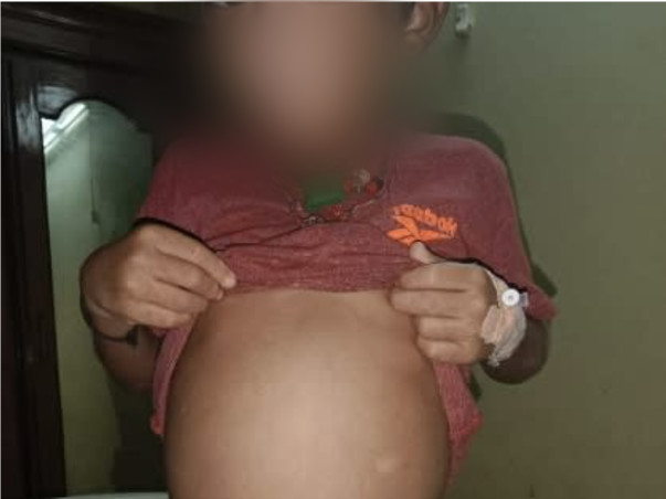 Support Nammi Chetan To Recover From Chediak Higashi Syndrome