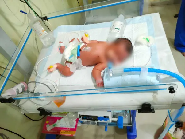 Help My Son Fight Ventricular Septal Defect & Lung Infection