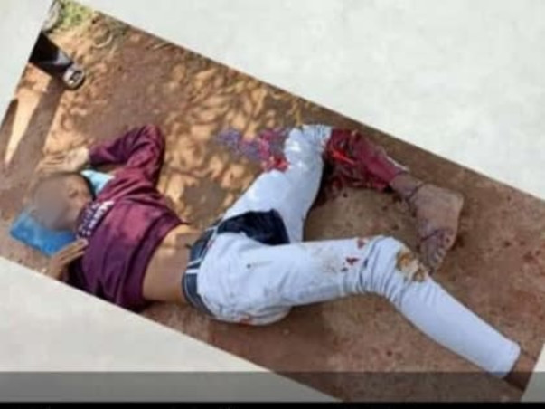 Help Naveen To Walk Again As He Met With Severe Leg Accident