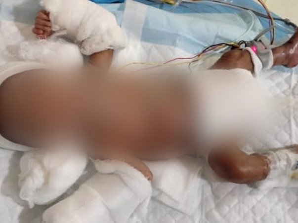 My son is struggling with digestion & breathing problems ,Please help