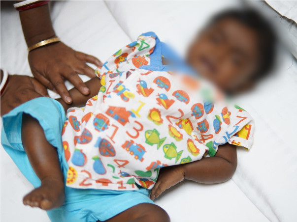 Failing Liver Has Put This Baby's Life At Stake, Needs A Transplant