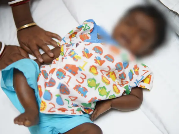 Failing Liver Has Put This Baby's Life At Stake, Needs A Transplant