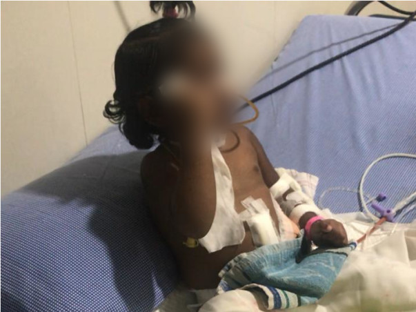 4 Years Old Needs Your Urgent Support In Fighting Corrosive Injury Of Oesophagus