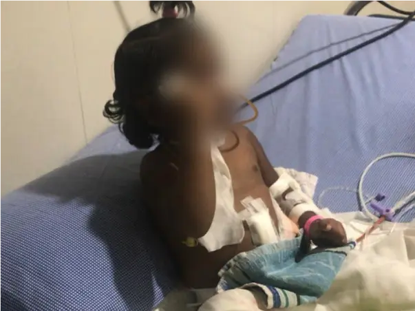 4 Years Old Needs Your Urgent Support In Fighting Corrosive Injury Of Oesophagus