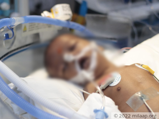 3 months old Priyansh needs your help fight TAPVC