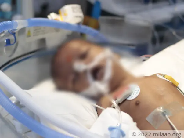 3 months old Priyansh needs your help fight TAPVC