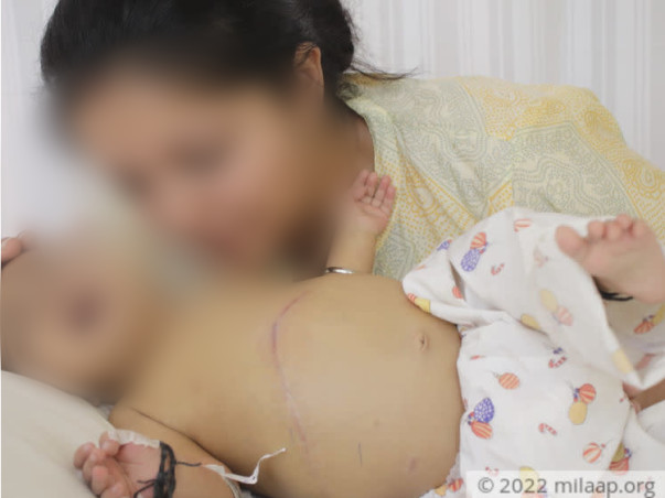 3 months old Baby Nisha needs your help fight liver transplant