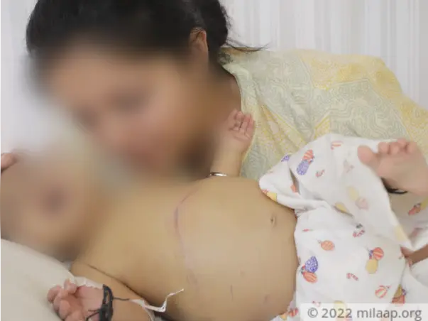 3 months old Baby Nisha needs your help fight liver transplant
