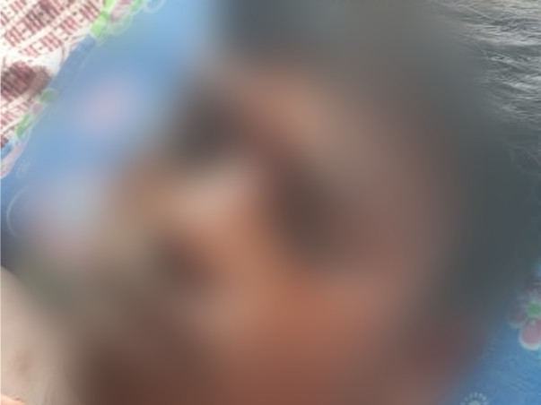 15Years Old Balachandar Needs Your Help To Recover Accident Trauma