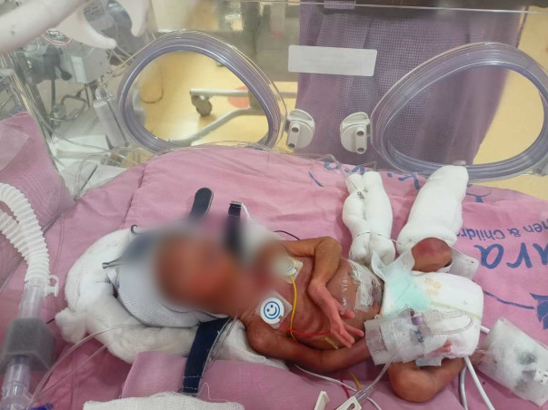 My Baby Needs Your Help To Survive Premature Birth Complications