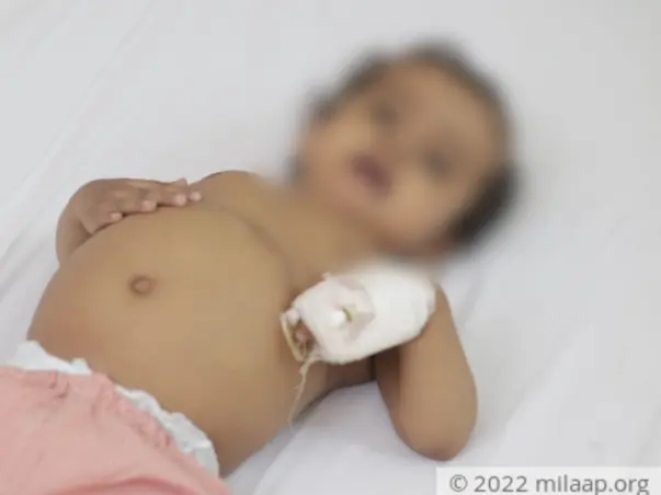 1 Year Old Utkarsh Needs Your Help Fight Liver Transplant