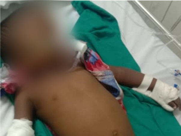 Support Sanjith Recover From B cell Acute lymphoblastic leukemia.