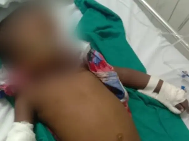 Support Sanjith Recover From B cell Acute lymphoblastic leukemia.