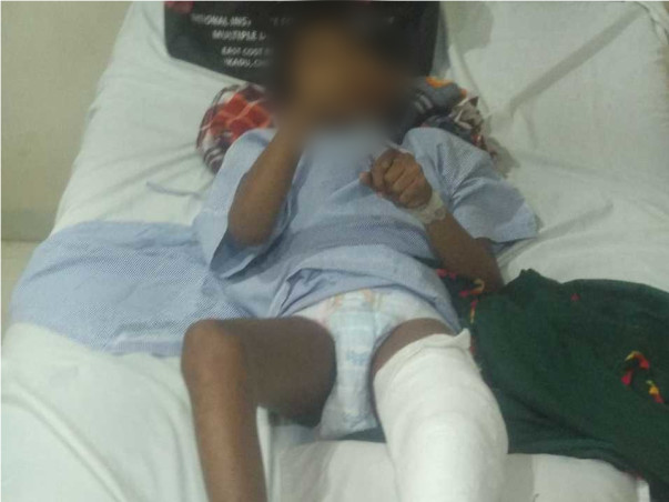 Help Vedant fight Cerebral Palsy