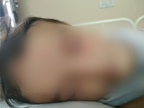 Support Shiwansh Dahal Fight from Juvenile Myelomonocytoc Leukemia