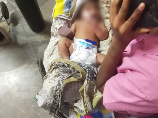 Support Baby of Pavani recover from Cardiac disease