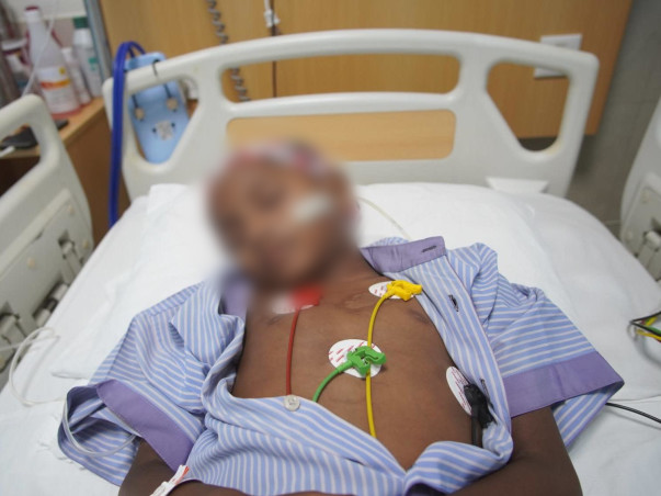 Support My Son To Recover From B-Non Hodgkin Lymphoma