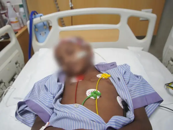 Support My Son To Recover From B-Non Hodgkin Lymphoma