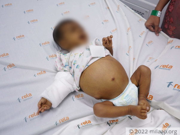 help-hardik-fm-nl