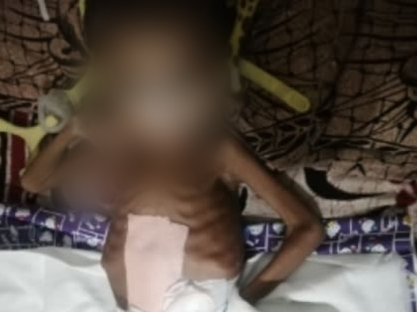 Support My Nephew To Recover Spinal Muscular Atrophy (SMA)