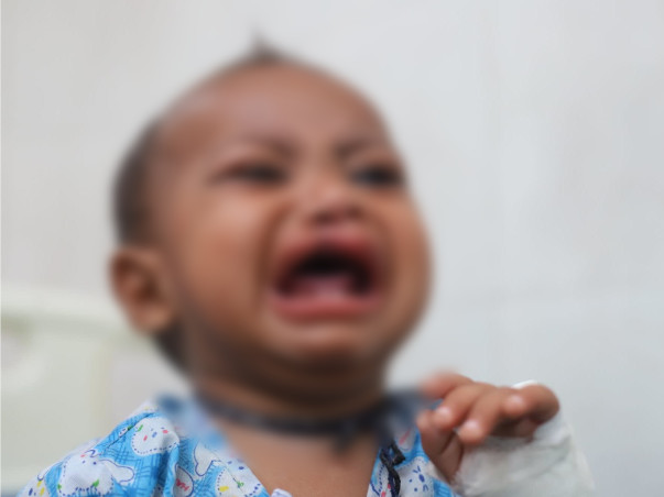 Baby Cannot Even Drink Milk Without Choking Due To Split Lip And Mouth