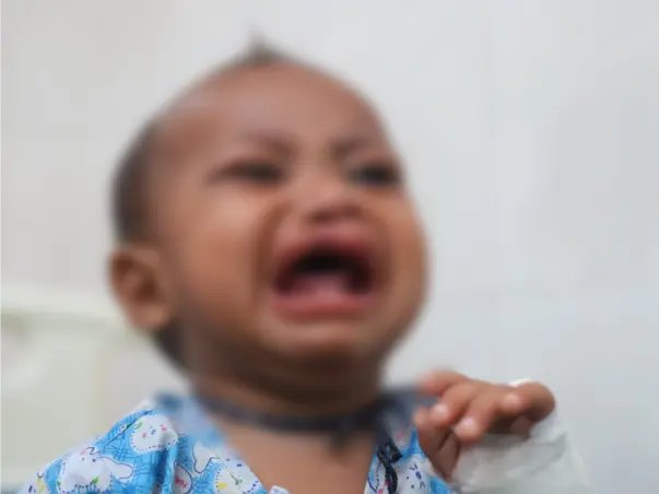 Baby Cannot Even Drink Milk Without Choking Due To Split Lip And Mouth