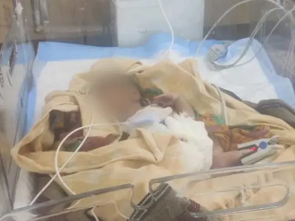 5 Days Old Baby Of Priti Kumari Needs Your Help Recover From Post Delivery Complications