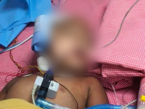 Support 3 Year Old Nitesh To Recover From Multi Organ Dys Syndrome