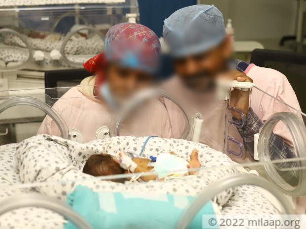 help-baby-of-swati-singh