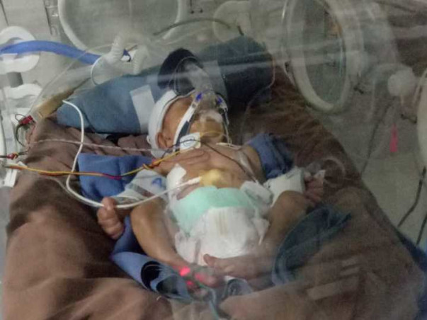 Help my premature baby to fight from life
