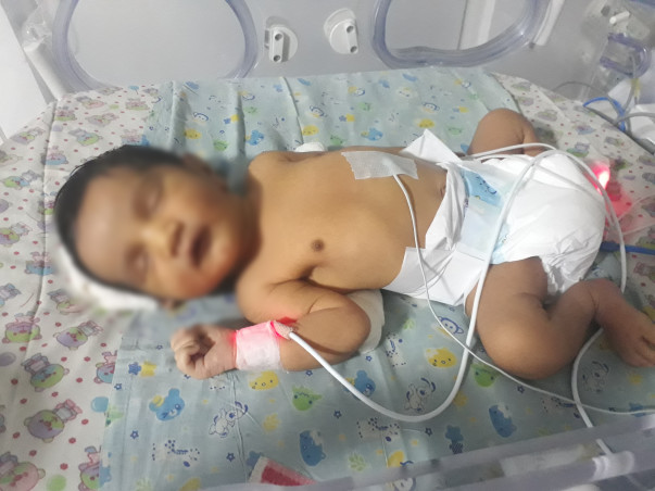 Please Save Premature Baby Girl Having Multiple Organ Failure