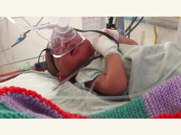 Help Our Baby Girl's Treatment for Brain Infection