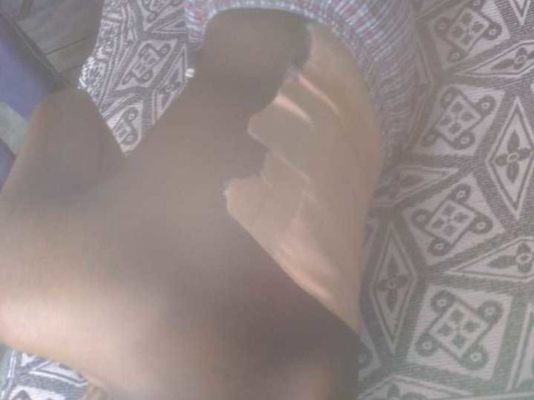 Help My Son For Leg and Spinal Injury