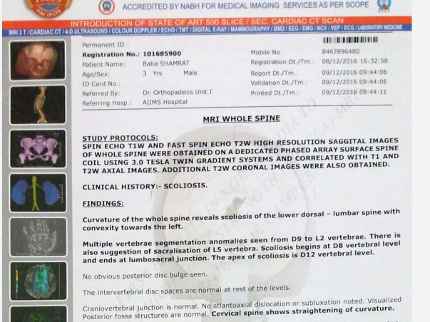 Help Smrat For His Operation Of Scoliosis