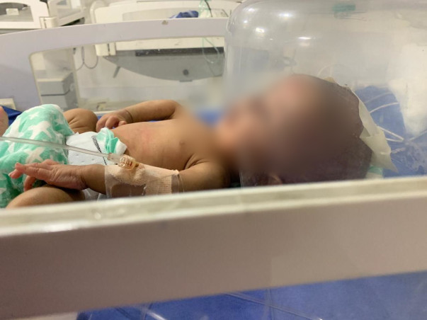 Help 2 Months Old Mahad Recover From Hypercephalus