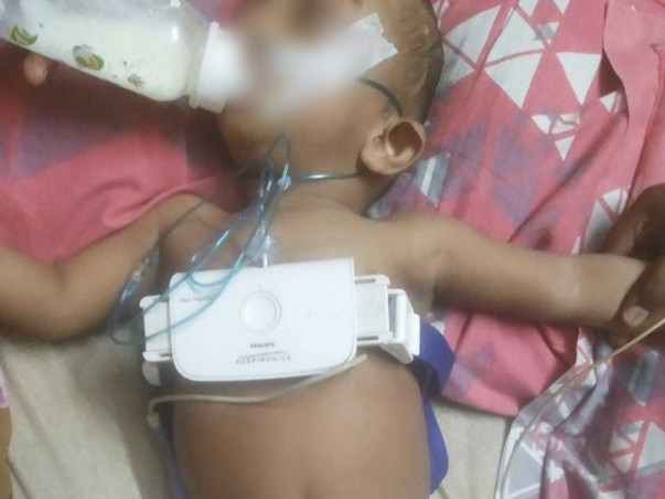 My Son Is Struggling With Craniosynostosis, Help Him