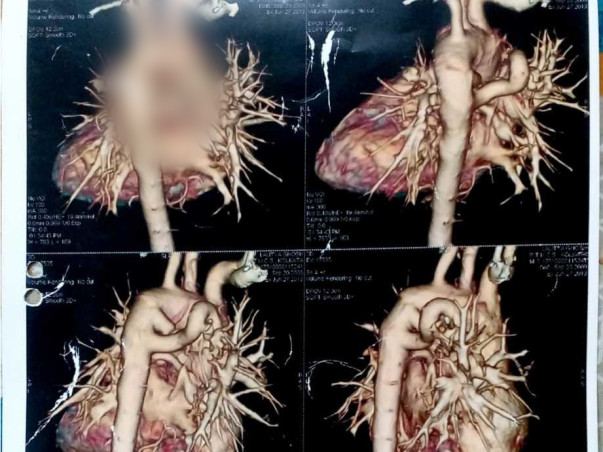 My 10-Year-Old Son Needs Your Urgent Support For Open Heart Surgery