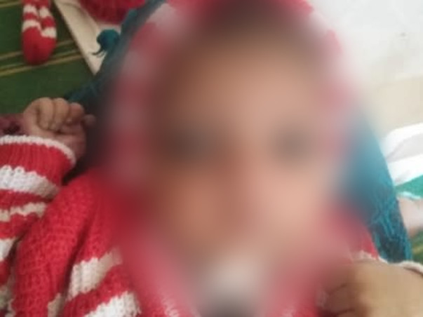 4 Months Old Harsha Needs Your Help To Recover From Heart Disease