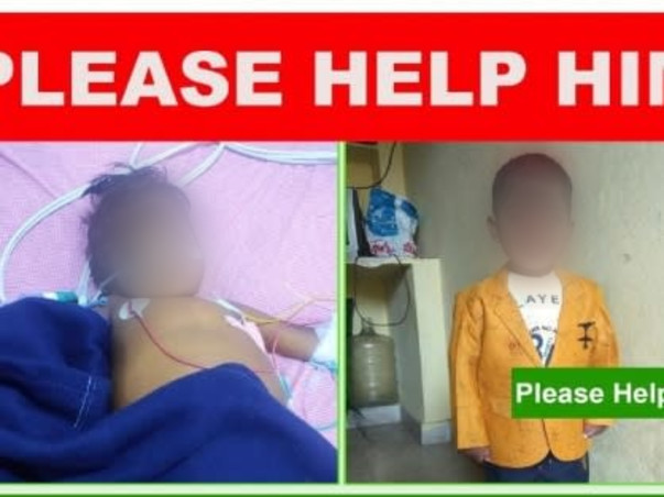 Help me fight Chronic Liver Disease