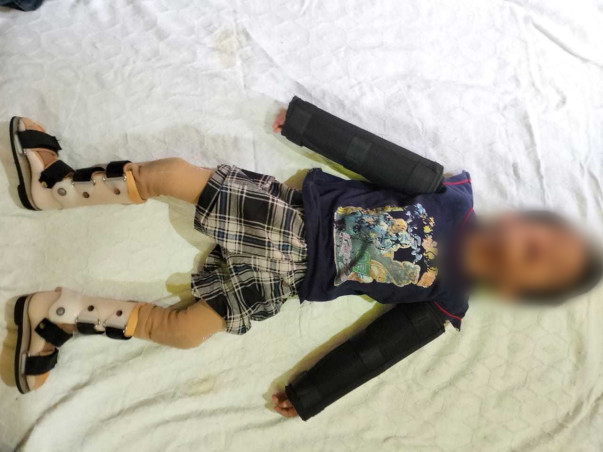 3 Years Old Md Hasan Usmani Needs Your Help To Recover From Cerebral Palsy